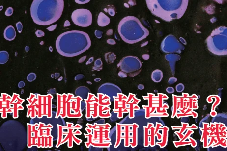 幹細胞能幹甚麼？ 臨床運用的玄機 (上)